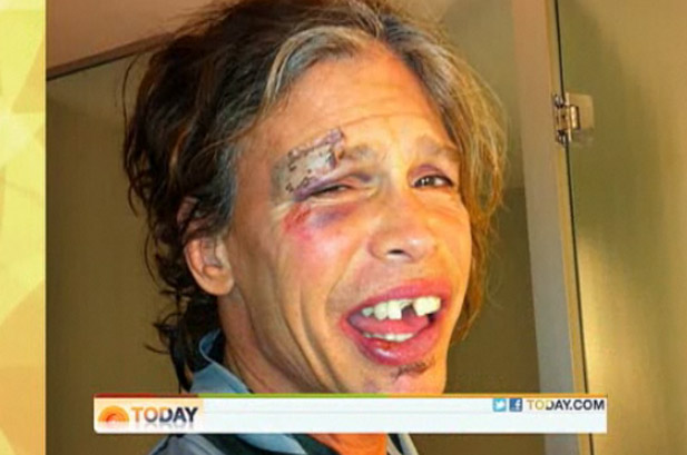 Steven Tyler, 63, após queda no banheiro. Foto: Billboard