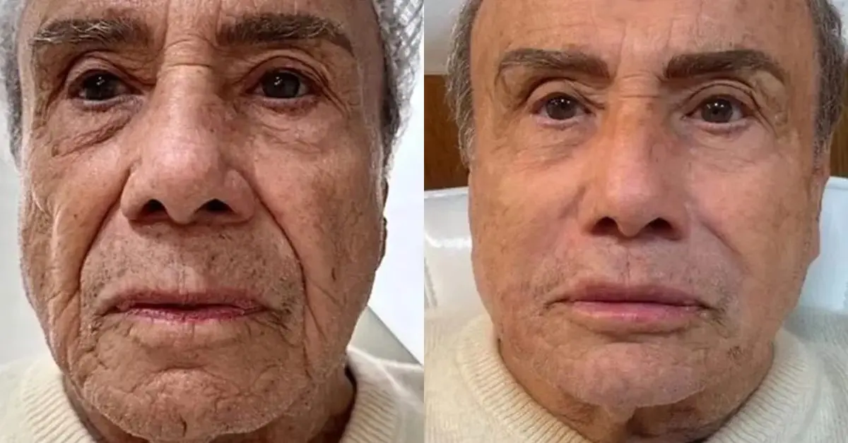 Antes e Depois - Stenio Garcia