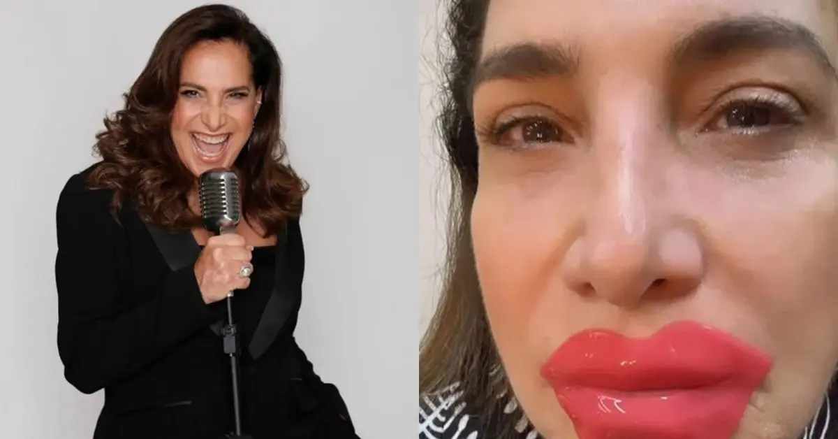 Aos 64, Totia Meireles faz post sobre harmonização facial