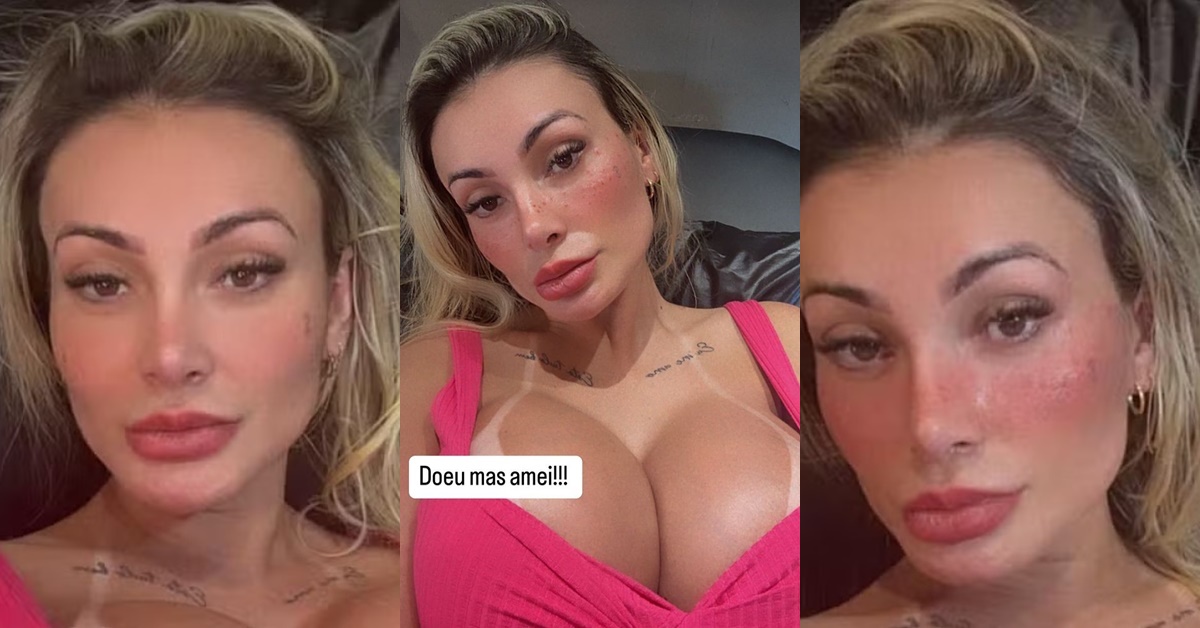 Andressa Urach - sardas no rosto