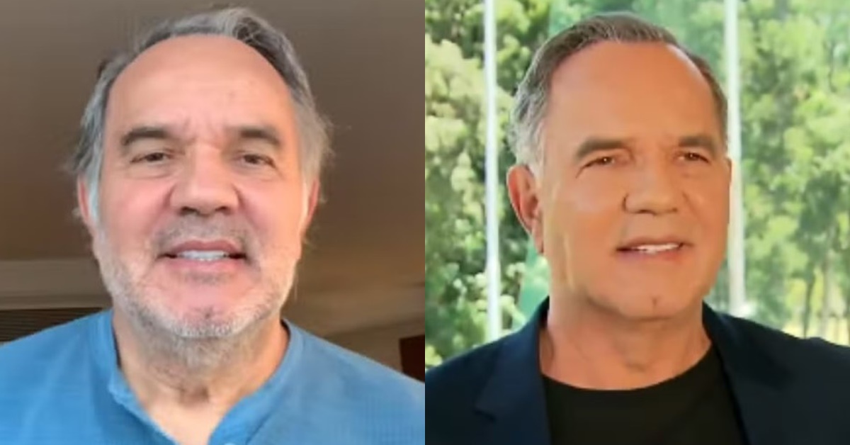 Humberto Martins - antes e depois - Harmonização Facial