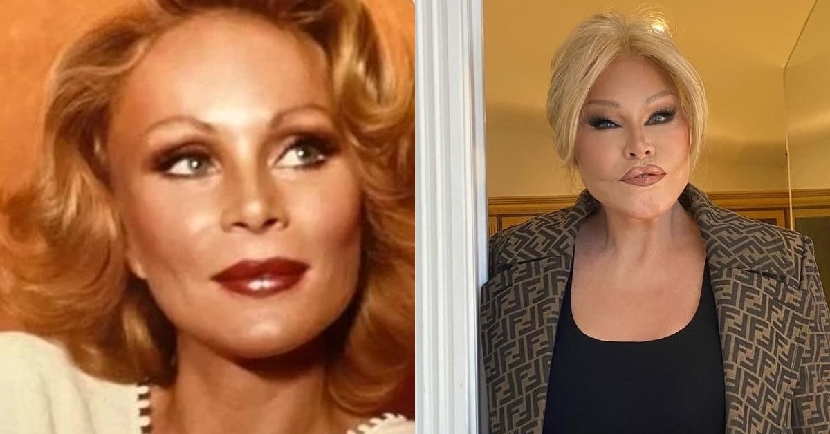 Jocelyn Wildenstein - passado e hoje